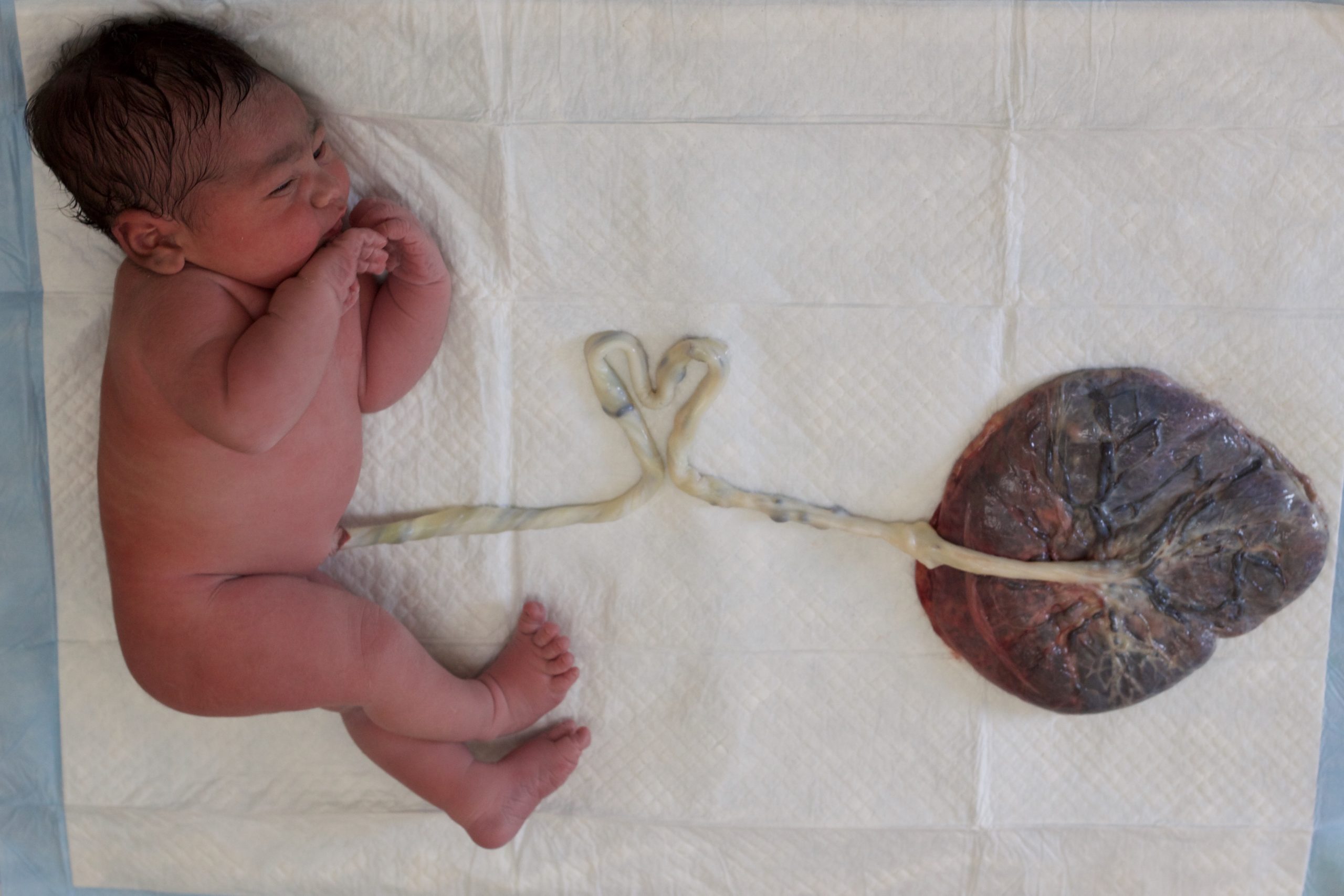 baby attached to placenta with a heart umbilical cord